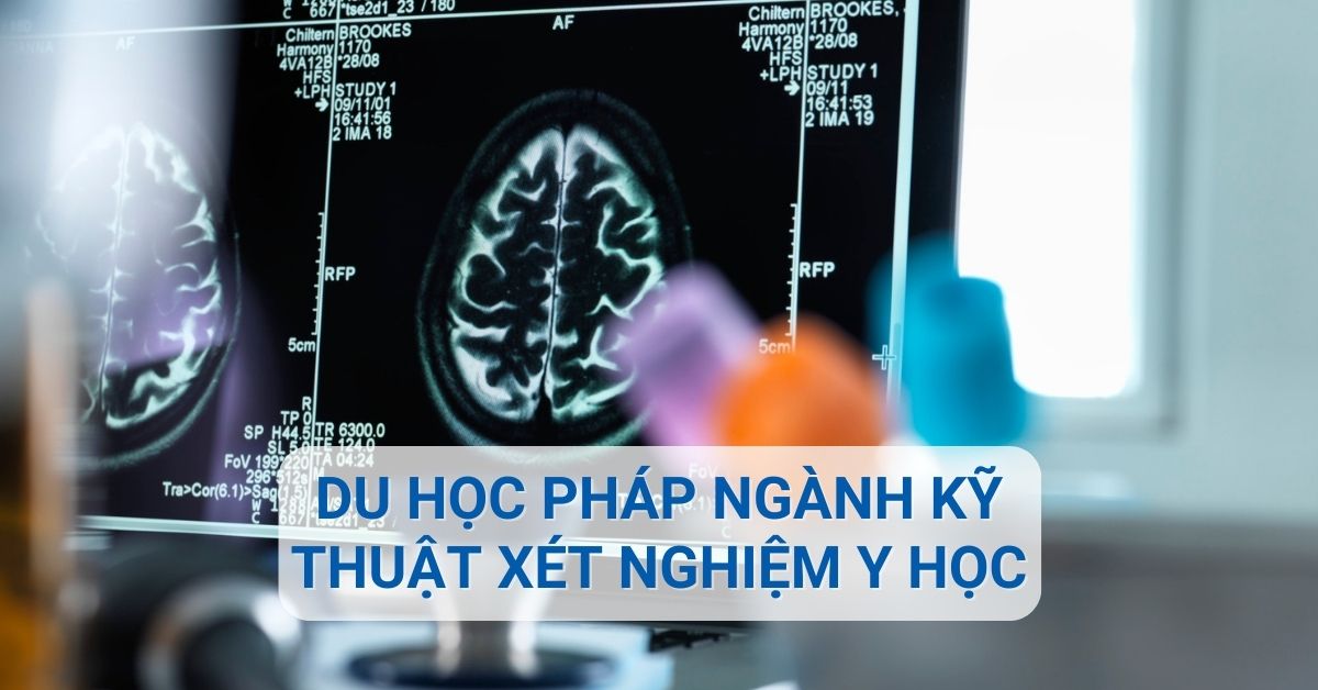 Du học Pháp ngành Kỹ thuật